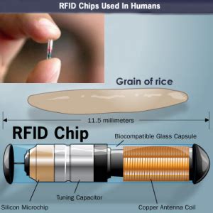 RFID Device and Obamacare 